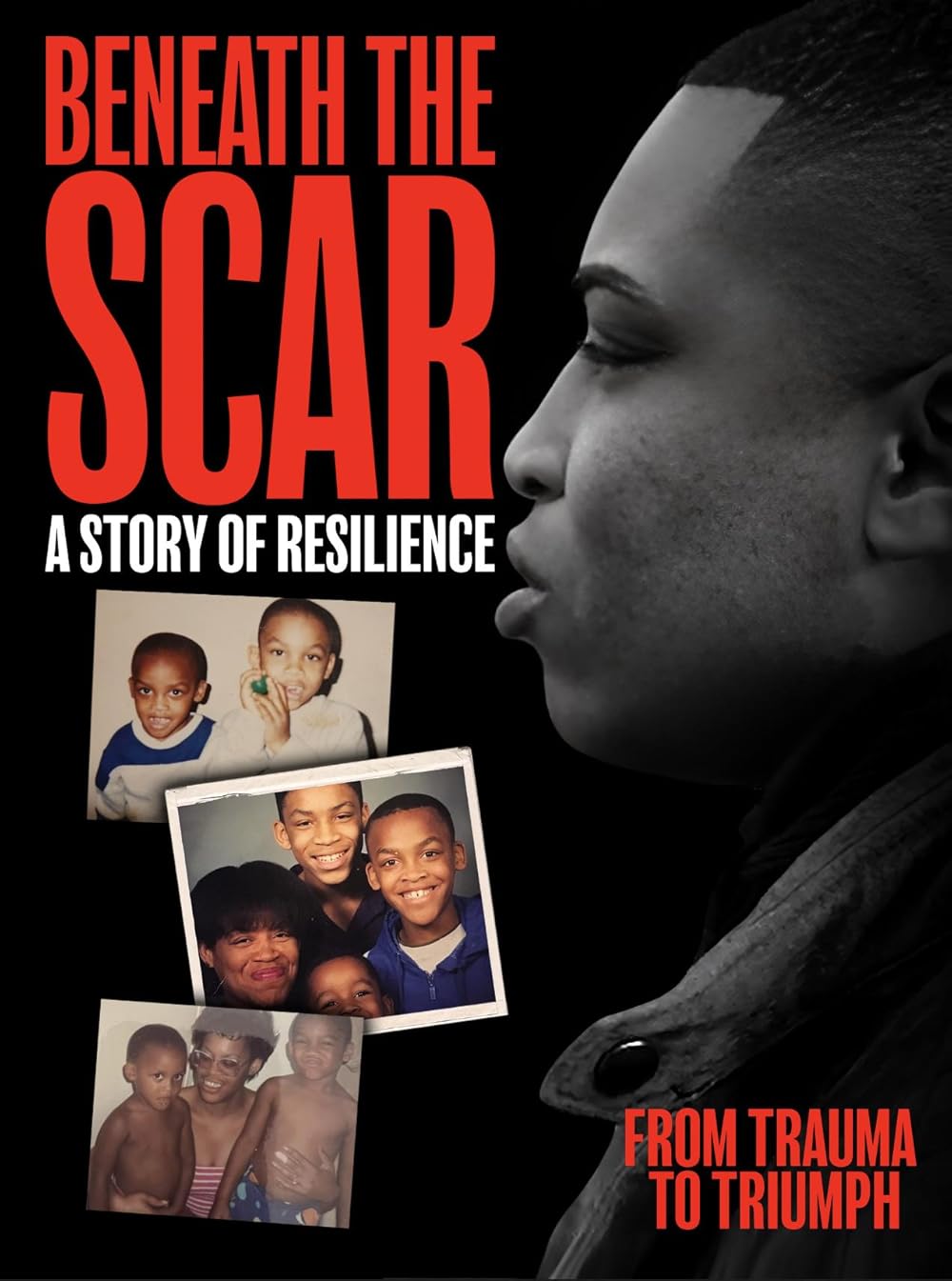 Beneath the Scar: A Story of Resilience (2025)